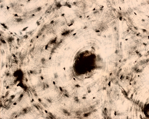 Ground section of bone