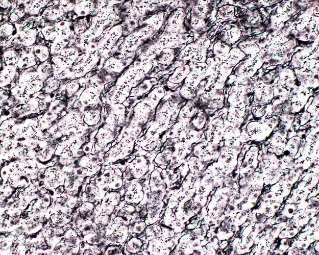 Haematoxillin stained liver
