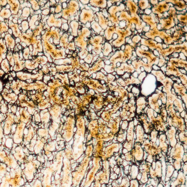 Silver stained liver