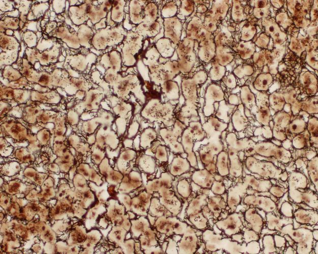 Haematoxillin stained liver