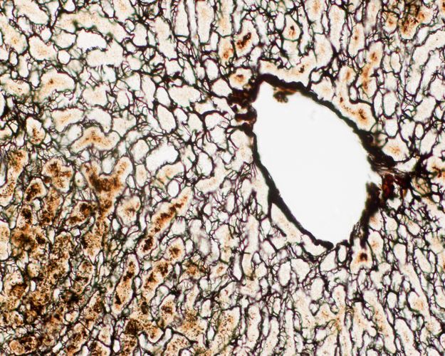 Silver stained liver