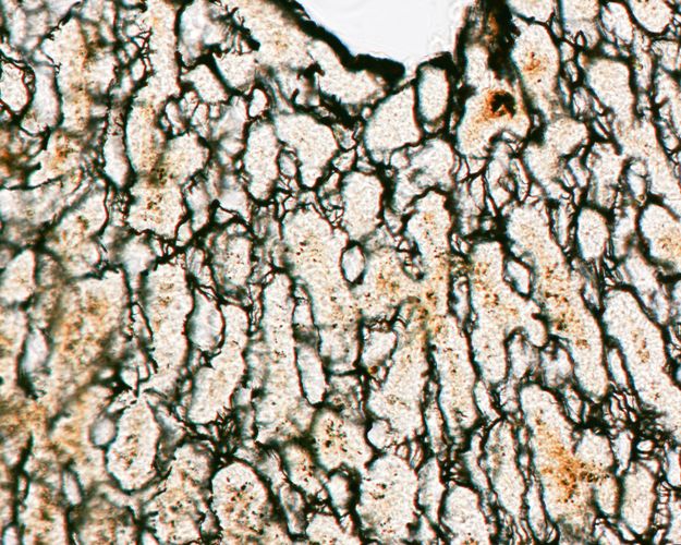 Silver stained liver