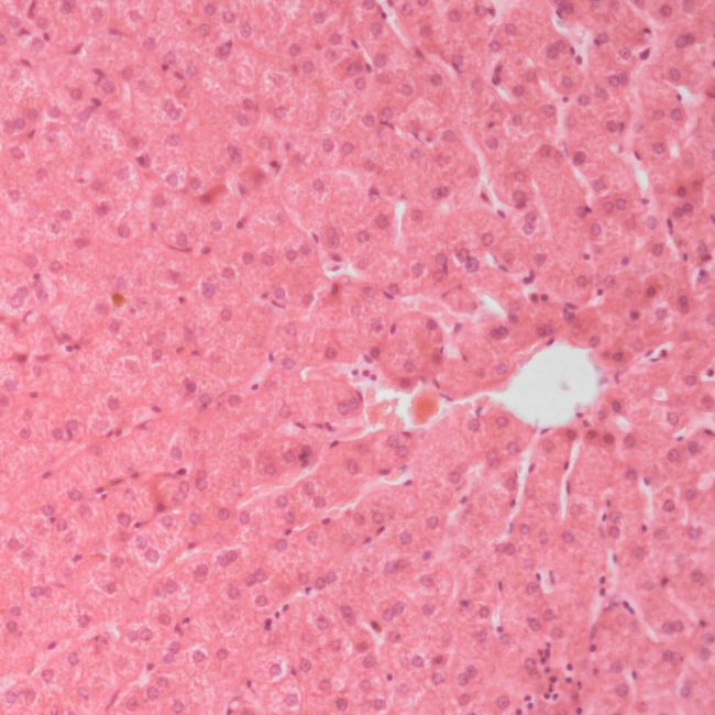 Haematoxillin stained liver