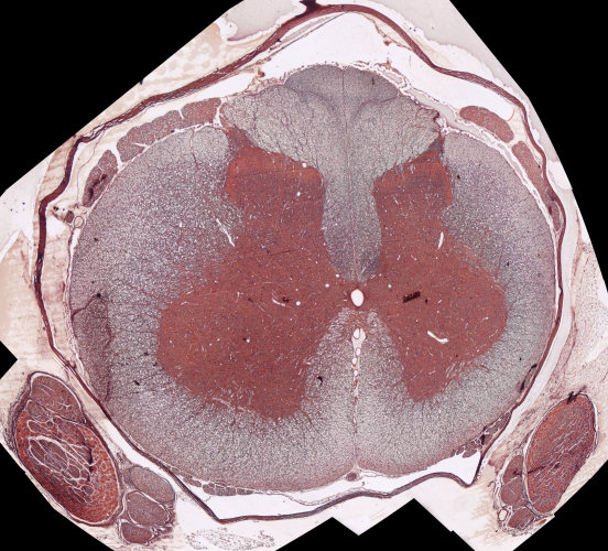Dwarssnit deur die rugmurg