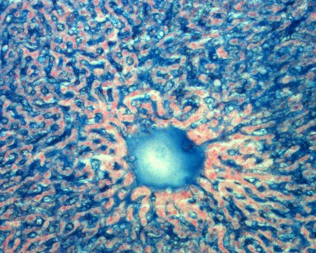 Haematoxillin stained liver